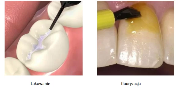 dzieci3_1485613 dzieci3_1485613