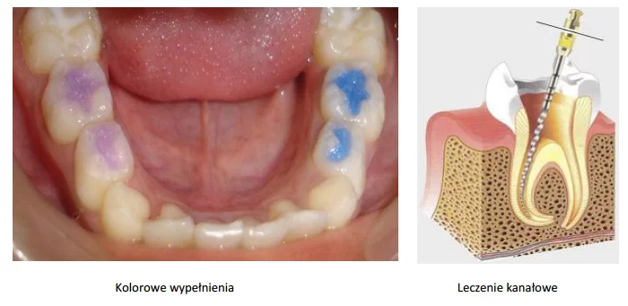 dzieci5_1490139 dzieci5_1490139