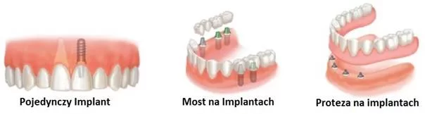 image004-1 image004-1