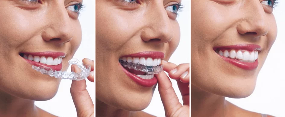 image015-1 image015-1