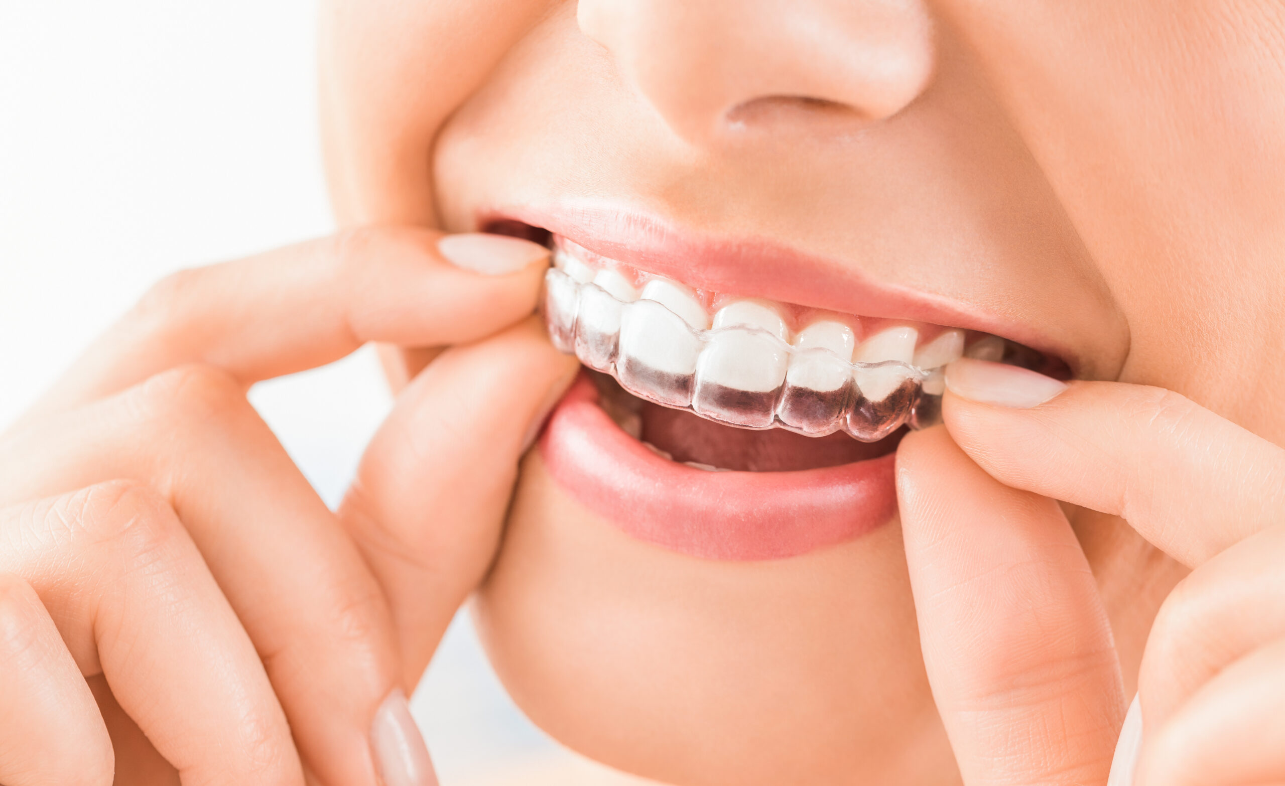 Beautiful smile and white teeth of a young woman. Beautiful smile and white teeth of a young woman.