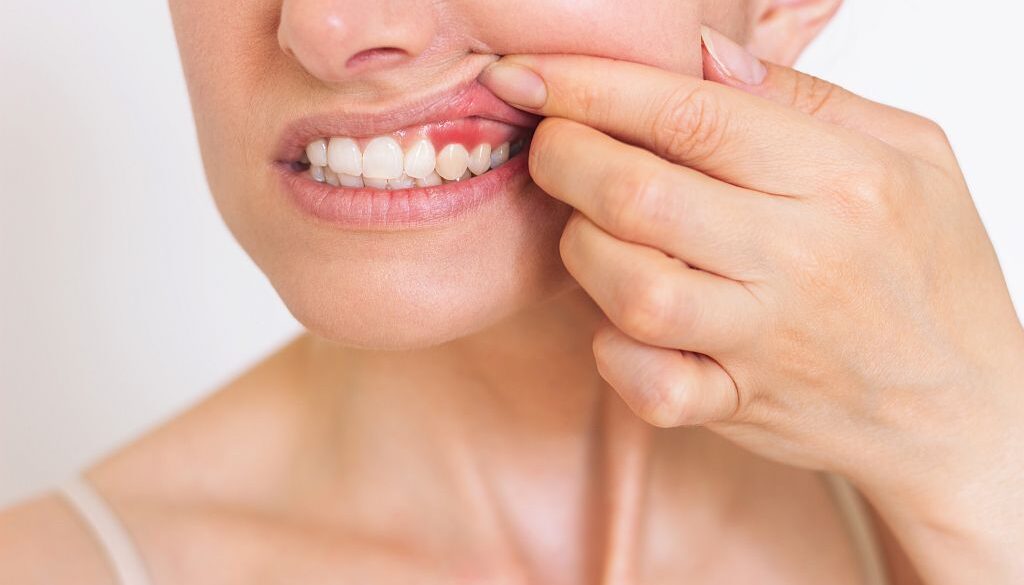 Jak wygląda leczenie paradontozy